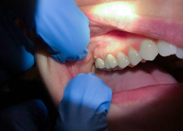 Best Emergency Cosmetic Dentistry (e.g., broken veneers) in Farragut, TN